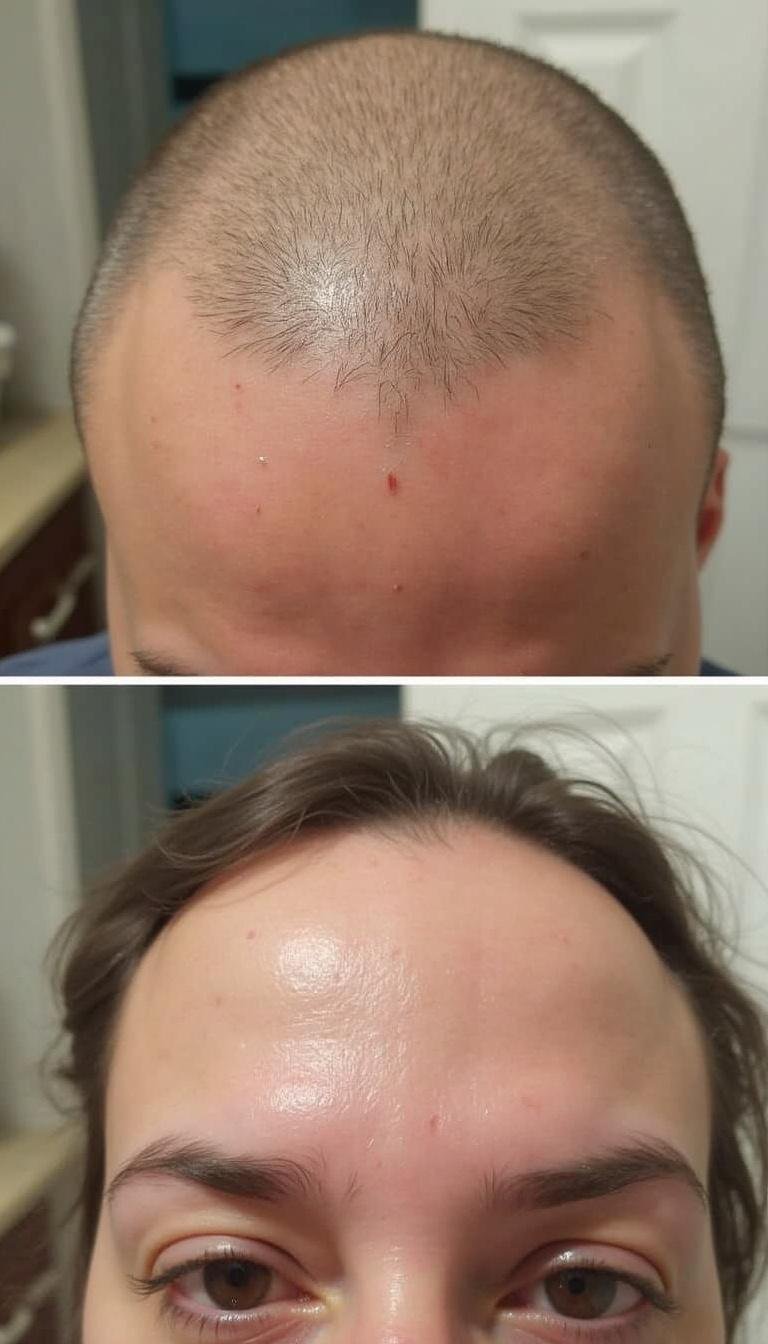 Comparison shot of scalp with dandruff and buildup before and after applying a DIY scalp scrub, illustrating effectiveness